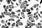 Coxiella burnetii © Rocky Mountain Laboratories, NIAID, NIH - PD-USGOV-HHS-NIH