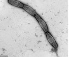 Burkholderia mallei, unflagellated bacteria (chain forming) © RKI
