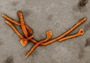 Ebola virus © RKI