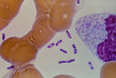 Yersinia pestis © CDC/PHIL (1993) - ID 2050