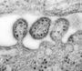 Lassa-Virus Virionen CDC/ C. S. Goldsmith, D. Auperin 